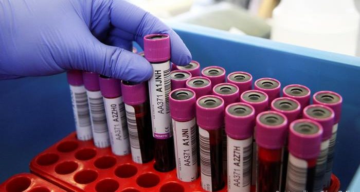 What you need to know about blood donation