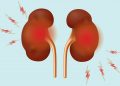 What Is the Best Thing to Drink for Your Kidneys