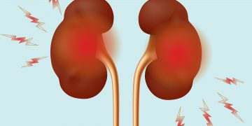 What Is the Best Thing to Drink for Your Kidneys